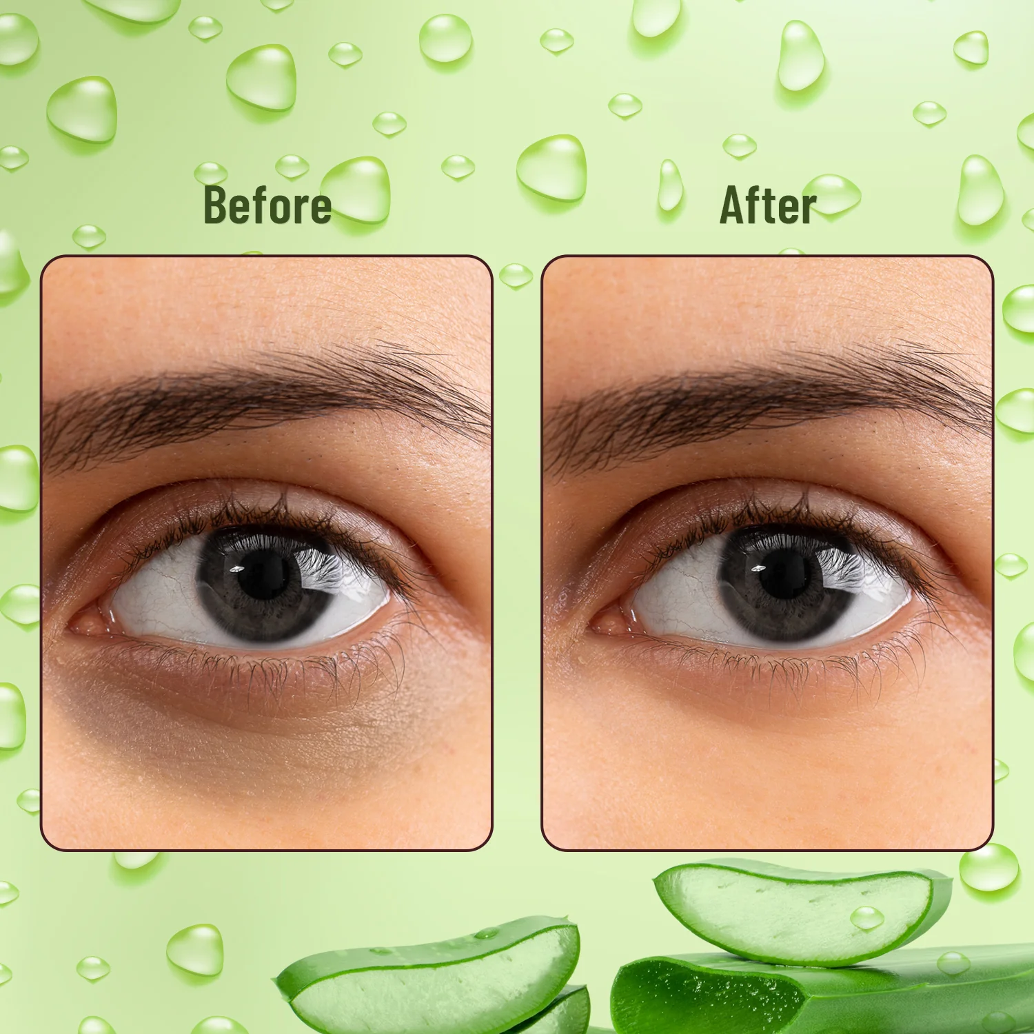 Hydra Eye Serum Patch with Aloe Vera - Image 7