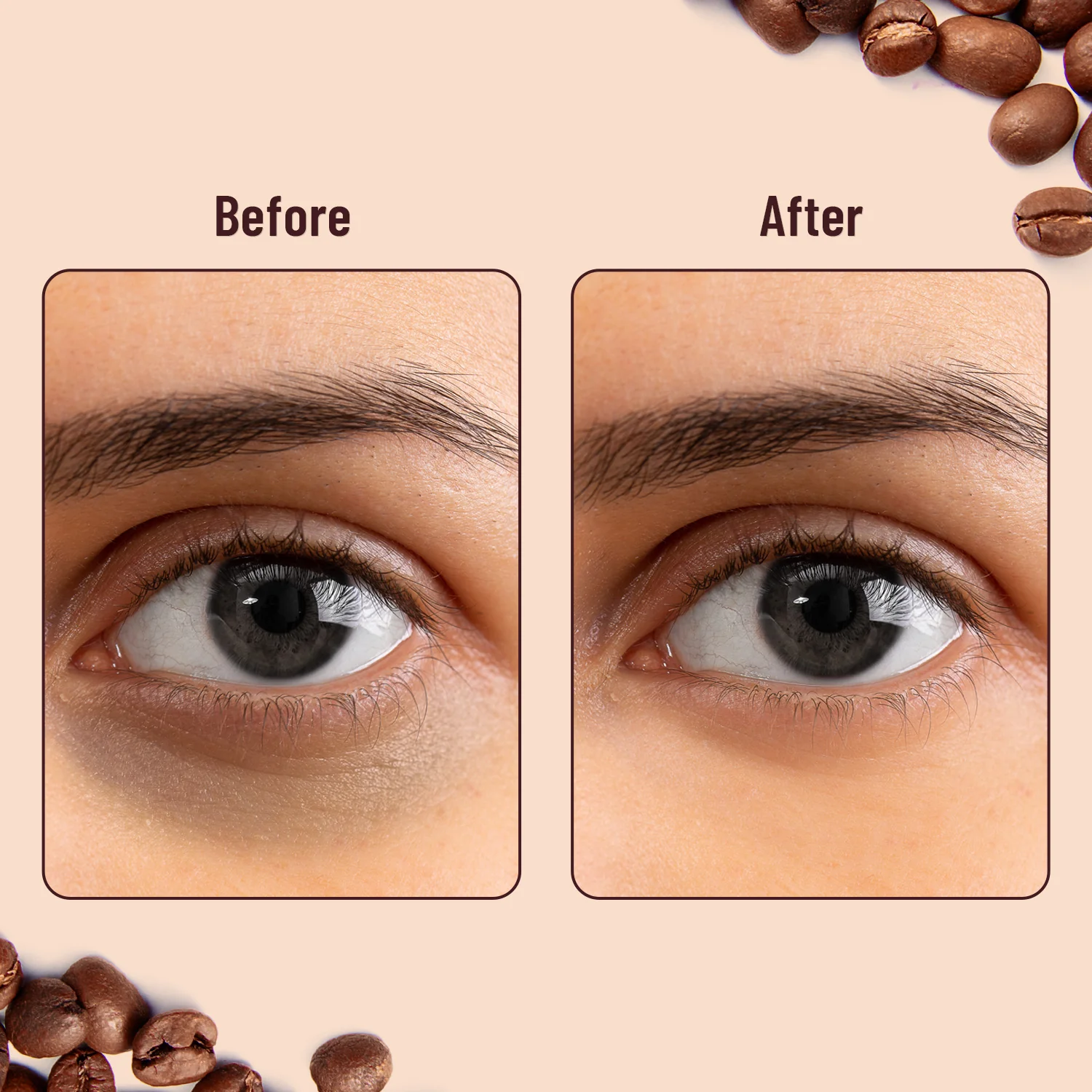 Hydra Eye Serum Patch with Coffee - Image 7